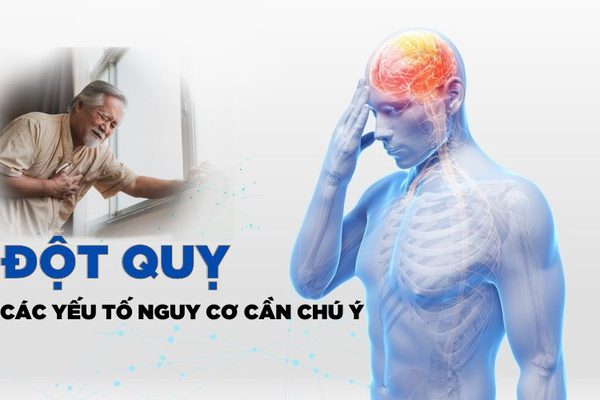 Đột quỵ do nắng nóng là tình trạng tăng thân nhiệt gây đáp ứng viêm hệ thống dẫn tới tổn thương nhiều cơ quan trong cơ thể, trong đó tổn thương thần kinh là nổi bật.